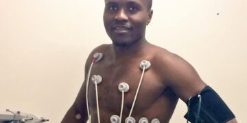 Transert : Nguemo dépose ses valises à Kayserispor FK